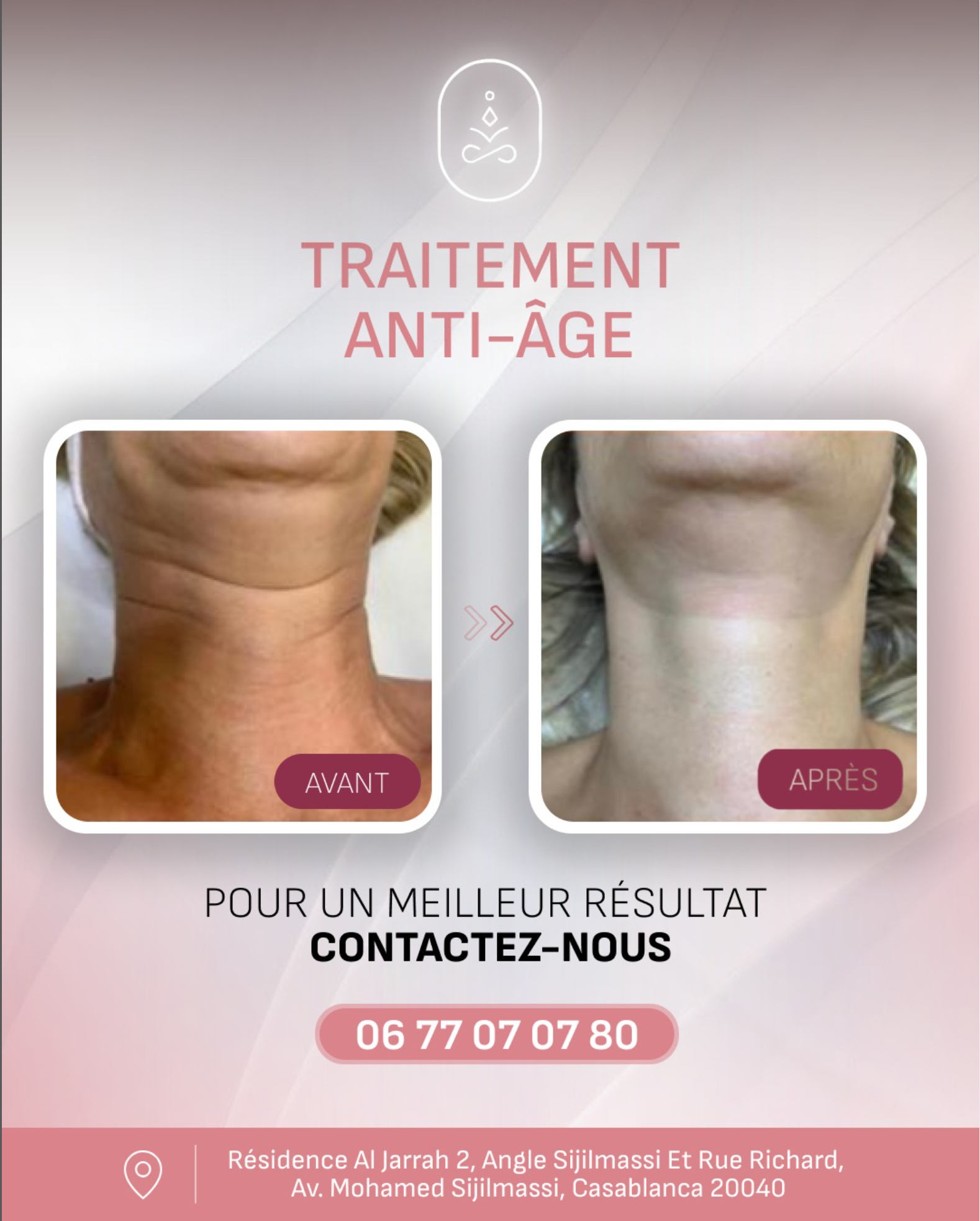 SKINERE - Post Instagram 3